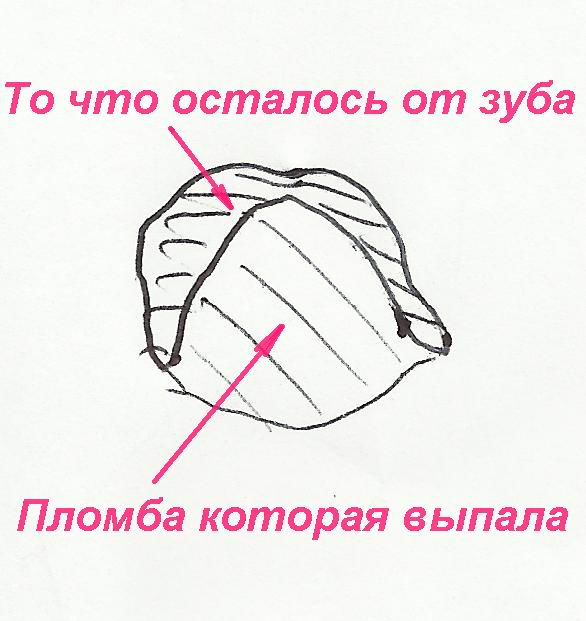 Мой любимый зубик.