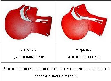 СЛР