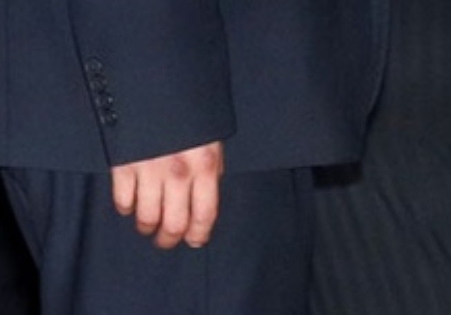 Ким б